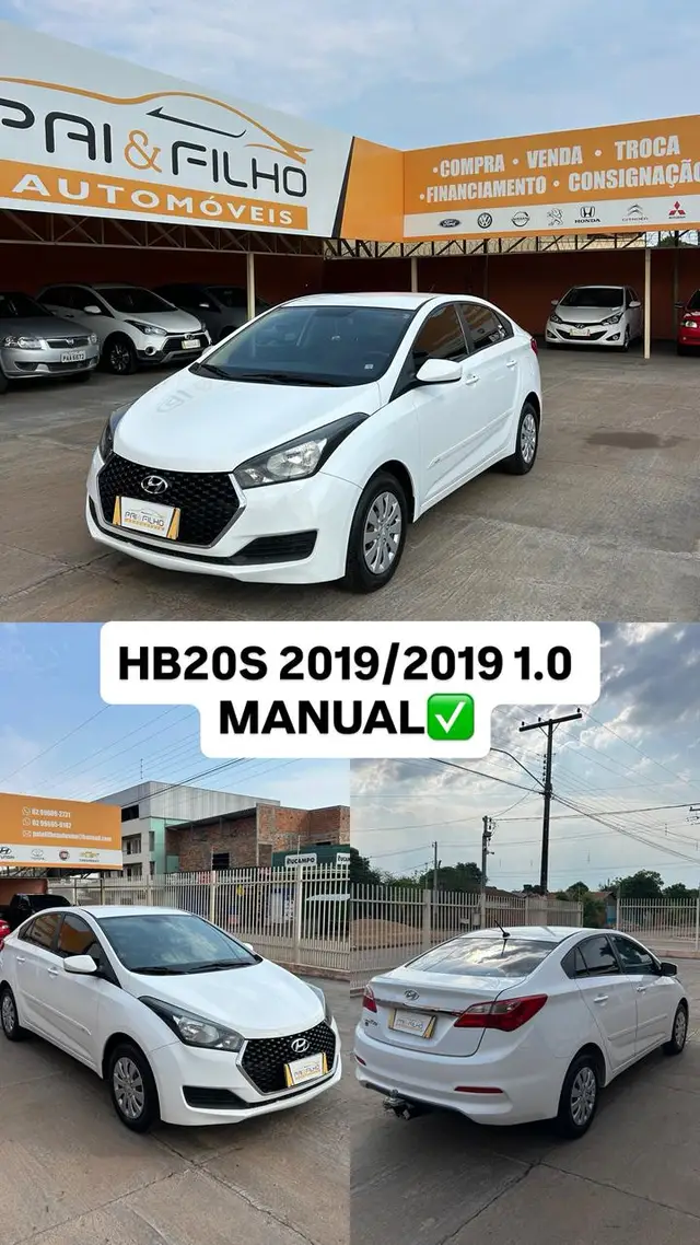 Carro Hyundai HB20S 2019 1.0 Unique (Flex)